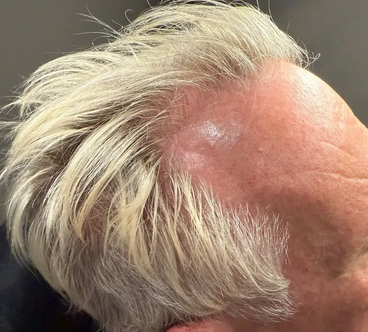 Jerry before Folix treatment