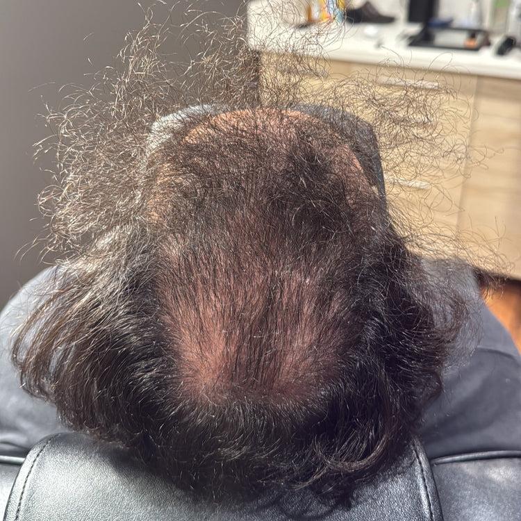 Vik T. after Folix treatment