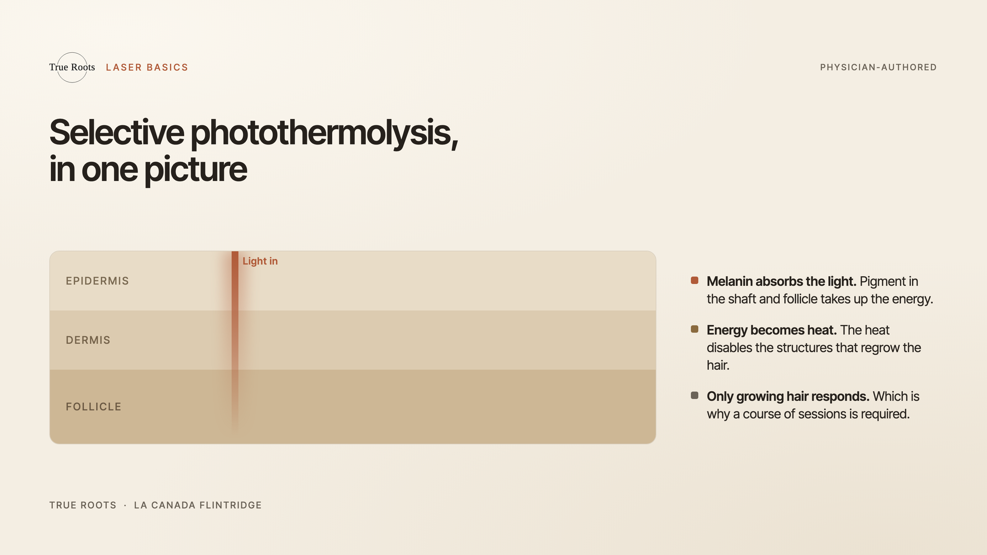 How laser light targets melanin in the hair follicle during laser hair removal